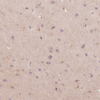 Anti-FMNL2 Antibody