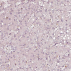 Anti-FMNL2 Antibody