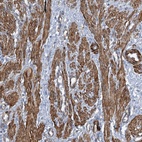 Anti-ZNF490 Antibody