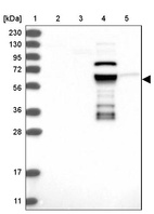 Lane 1: Marker [kDa] 230, 130, 95, 72, 56, 36, 28, 17, 11_br/_Lane 2: Human cell line RT-4_br/_Lane 3: Human cell line U-251MG sp_br/_Lane 4: Human plasma (IgG/HSA depleted)_br/_Lane 5: Human liver tissue