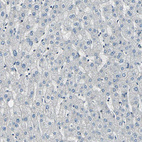 Anti-POLR3K Antibody