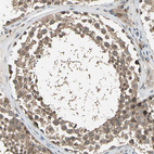 Anti-NFKBIE Antibody