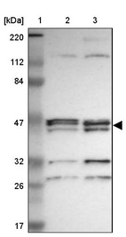 Anti-PARVA Antibody