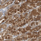 Anti-GLCCI1 Antibody