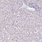 Anti-TEX33 Antibody