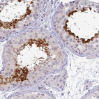 Anti-TEX33 Antibody