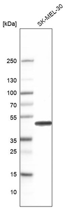 Anti-CALU Antibody