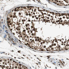 Anti-ZNF18 Antibody