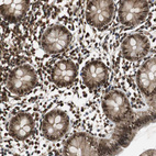 Anti-ZNF18 Antibody