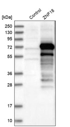 Anti-ZNF18 Antibody