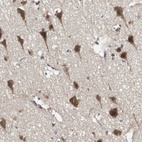 Anti-PFDN1 Antibody