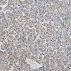 Anti-CHP1 Antibody