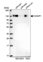 Anti-CHAMP1 Antibody