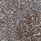 Anti-FEN1 Antibody