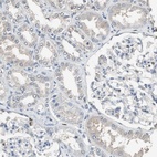 Anti-FEN1 Antibody