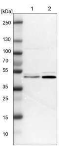 Anti-FEN1 Antibody