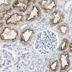 Anti-VIL1 Antibody