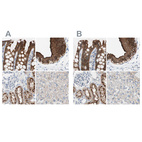 Anti-VIL1 Antibody