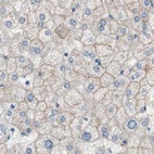 Anti-VIL1 Antibody