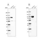 Anti-VIL1 Antibody