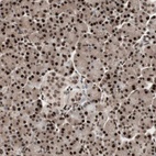 Anti-TSHZ1 Antibody