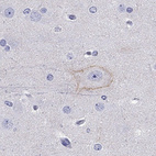 Anti-CDH9 Antibody