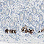 Anti-SULT1C2 Antibody