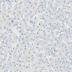 Anti-SULT1C2 Antibody