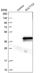 Anti-SULT1C2 Antibody