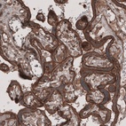 Anti-LSR Antibody