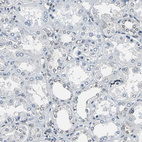 Anti-LSR Antibody