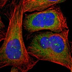 Anti-CTTNBP2NL Antibody