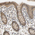 Anti-S100A6 Antibody