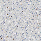 Anti-S100A6 Antibody