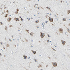 Anti-PLCXD1 Antibody