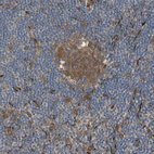 Anti-FGD6 Antibody