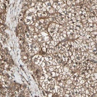 Anti-FKBP15 Antibody