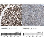 Anti-UQCRC2 Antibody