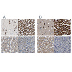 Immunohistochemical staining of human cerebral cortex, heart muscle, liver and pancreas using Anti-UQCRC2 antibody HPA007998 (A) shows similar protein distribution across tissues to independent antibody HPA019146 (B).