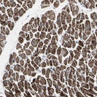 Immunohistochemical staining of human heart muscle shows high expression.