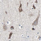 Anti-UQCRC2 Antibody