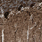 Immunohistochemical staining of human cerebellum shows positivity in purkinje cells.