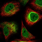 Immunofluorescent staining of human cell line A549 shows localization to nucleoplasm, nuclear membrane & intermediate filaments.