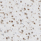 Anti-NUCB1 Antibody