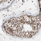 Anti-MMEL1 Antibody