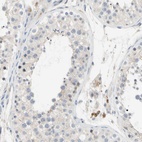 Anti-GAS6 Antibody