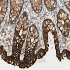 Anti-SKIL Antibody