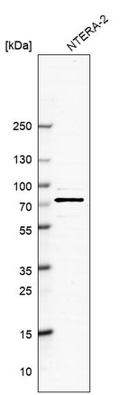 Anti-SKIL Antibody