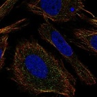 Anti-TMEM9 Antibody