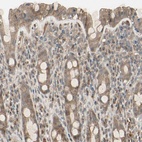 Anti-FHDC1 Antibody